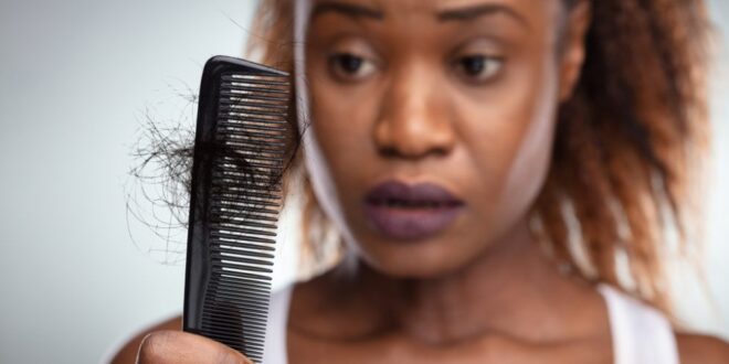 Josie vs Cancer: I thought I was ready for hair loss—I wasn’t!