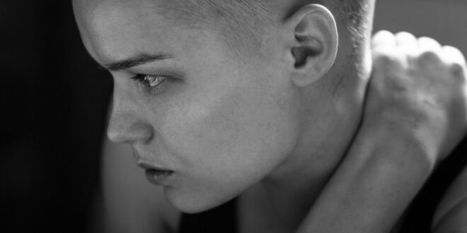 Josie vs Cancer: To protect my sanity, I constantly filtered offered advice