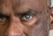 Dr Teelucksingh: Blind spots; what long lines for free cataract surgery says about T&T’s healthcare